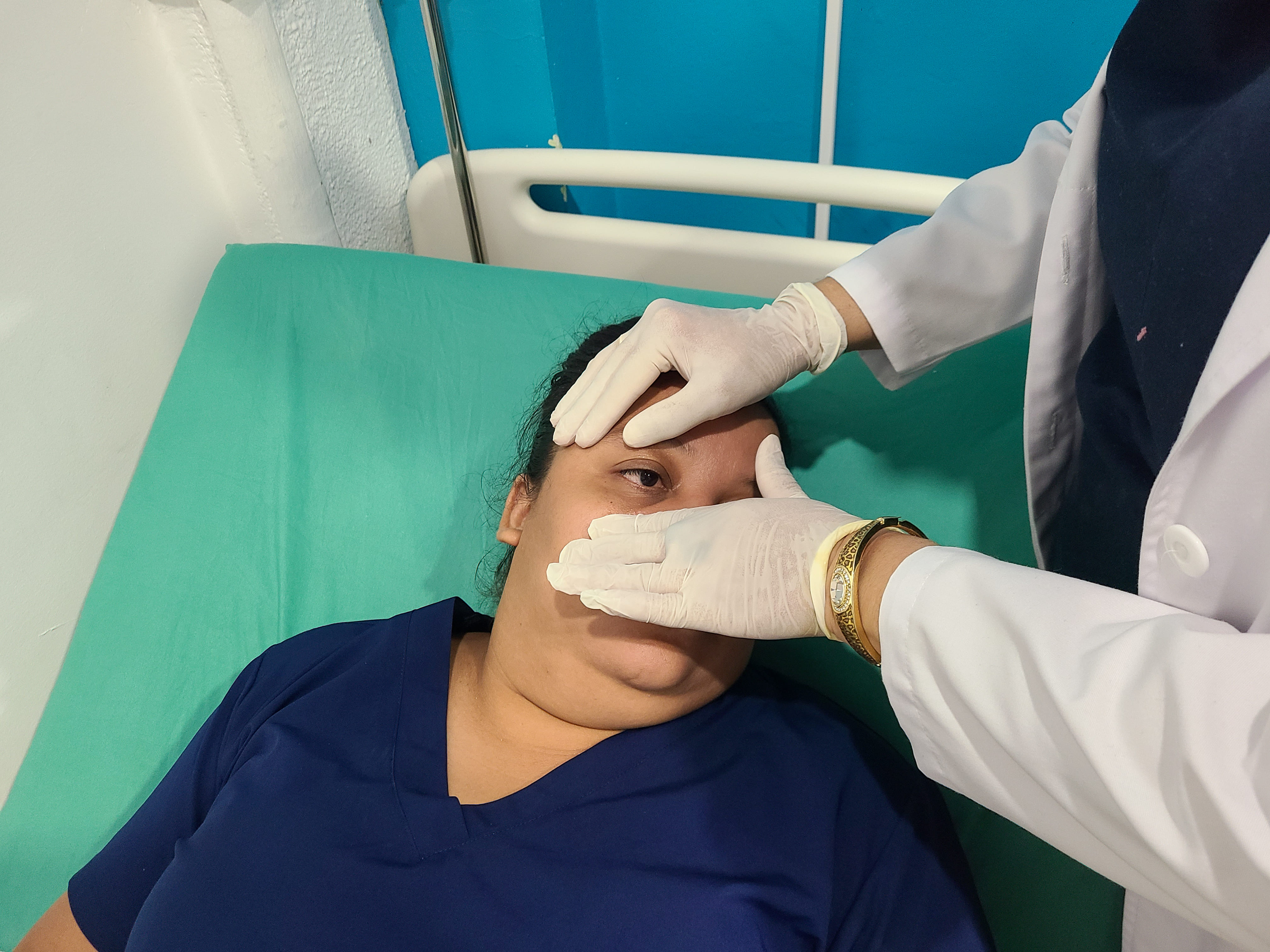 Tratamientos con Peeling Químicos