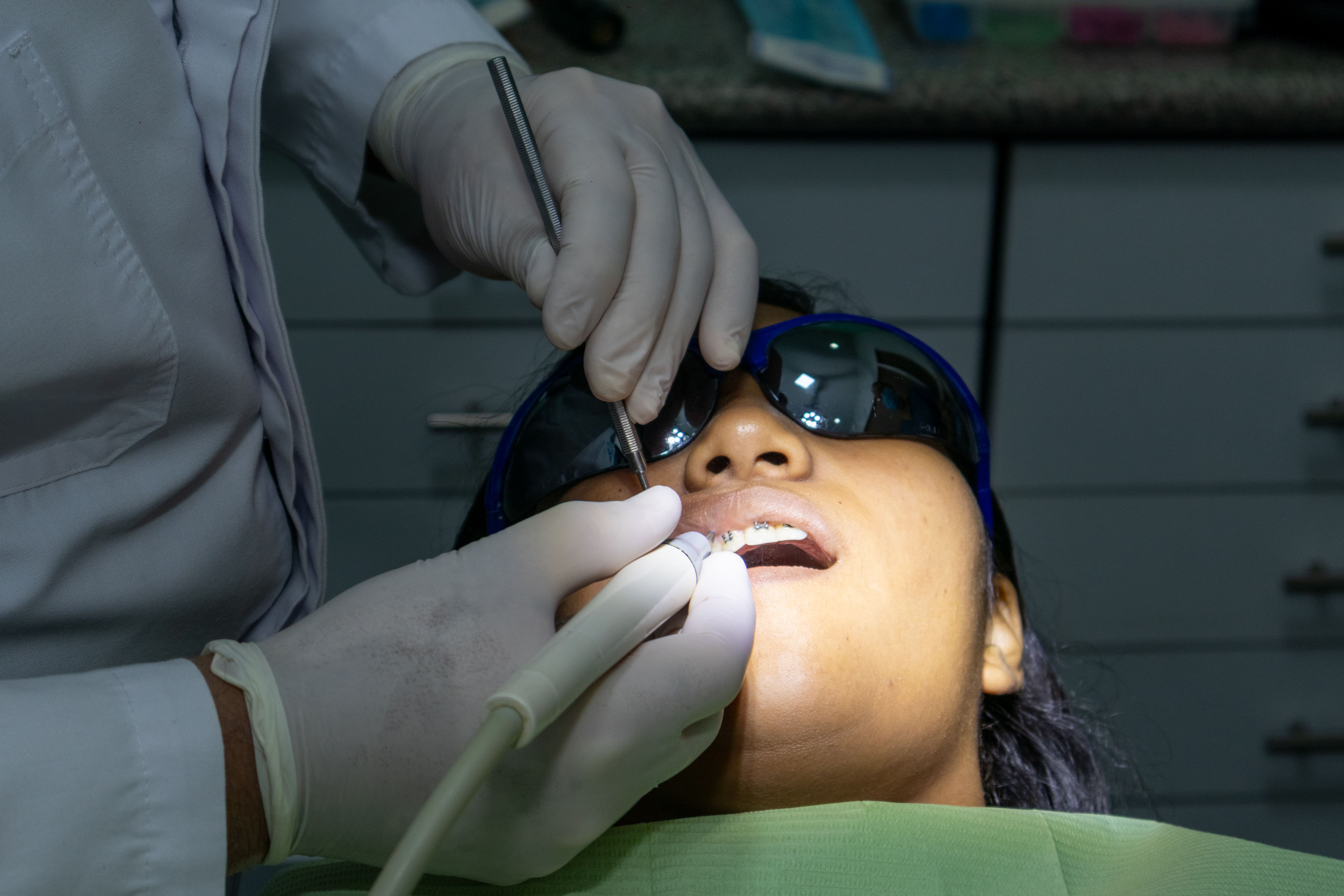 Limpieza Dental