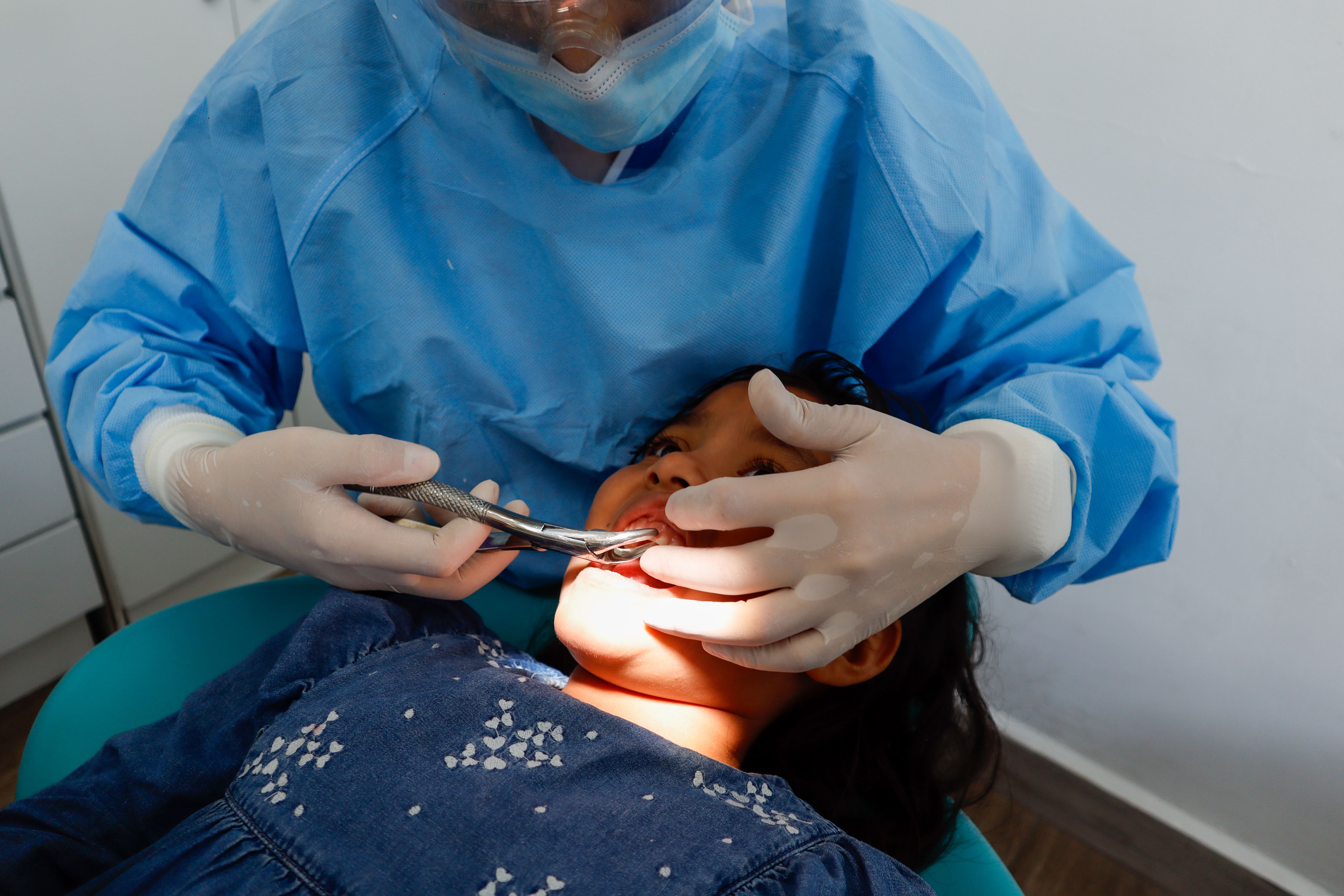 Extracción Dental