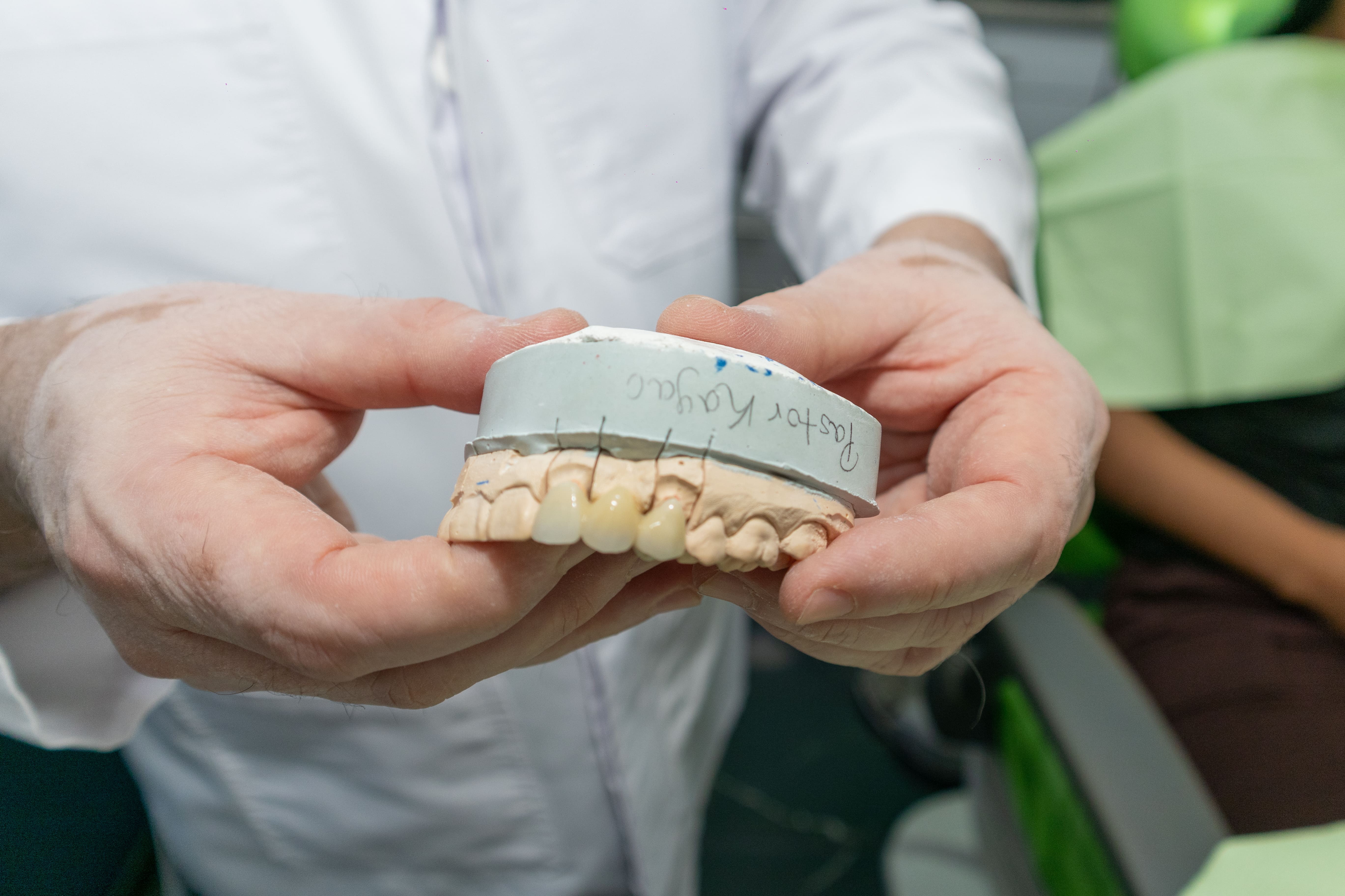 Implantes Dentales